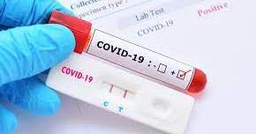 Povinné screeningové antigenní testování na Covid-19 a nabídka kvalitnějších a průkaznějších PCR testů pro naše žáky!